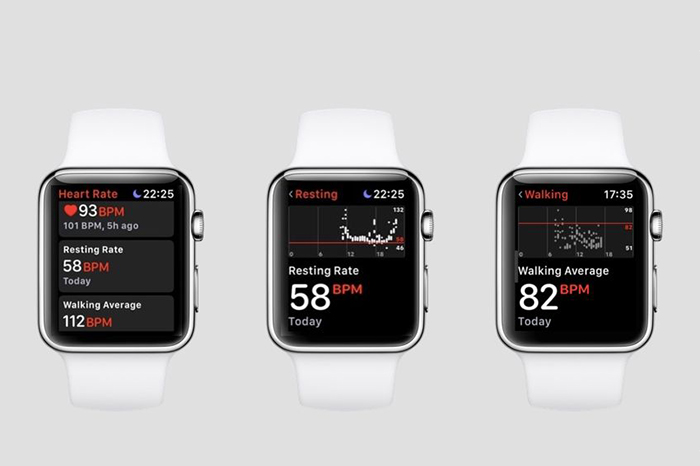 Apple улучшит технологию предупреждения инсульта на Apple Watch
