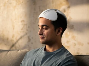 Восстановитель волос Niostem Smart Hair Loss Wearable с регенерацией  - Фото 1